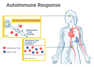 A diagram about the autoimmune response to multiple sclerosis.