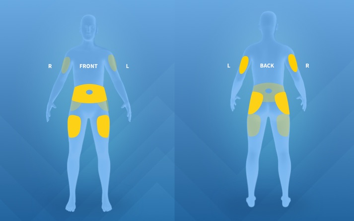 A diagram of the three injection sites located on the front of the body and a diagram of the four injection sites on the back of the body for COPAXONE&reg; therapy.